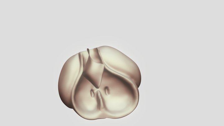 Embryonic Heart-Truncus Arteriosus 3D Model