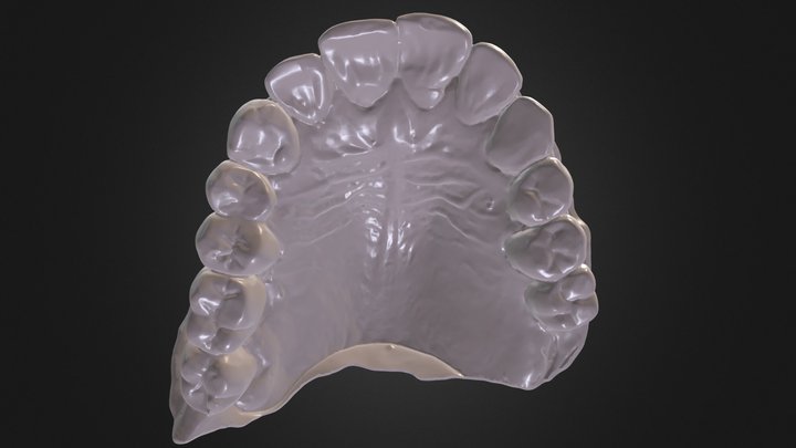 Maxillary Arch Case NN 3D Model