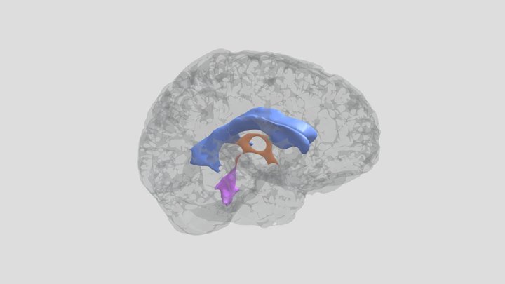 Ventrículos Cerebrales – Modello 3D gratuito STL