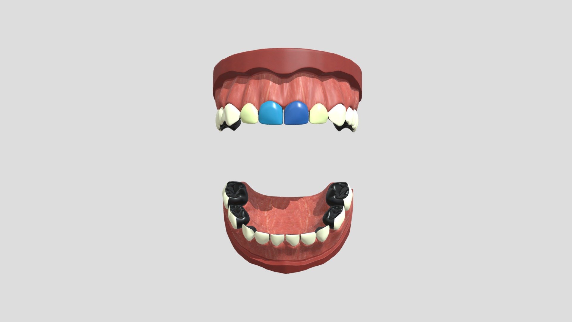 hypo_nzunrestored_4cm_3c