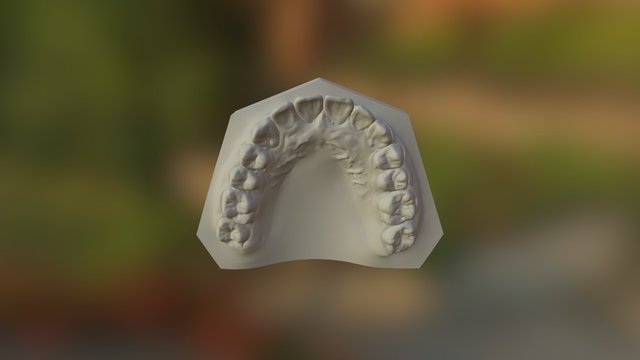 VS 2016-1-9 下午 04-23-23 Maxillar (1) 3D Model