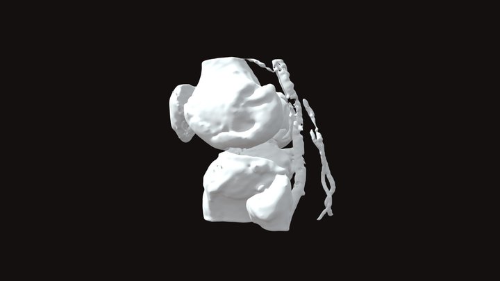 PrPaLtBone0126_artery 3D Model