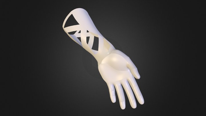 Diseño Prótesis Hombre N2 3D Model