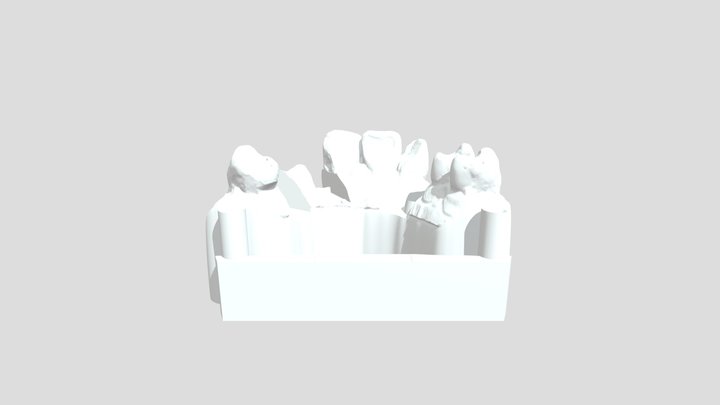modelo de implante 3D Model