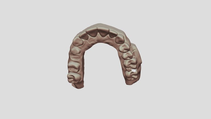 8 Upper Jaw Scan 3D Model