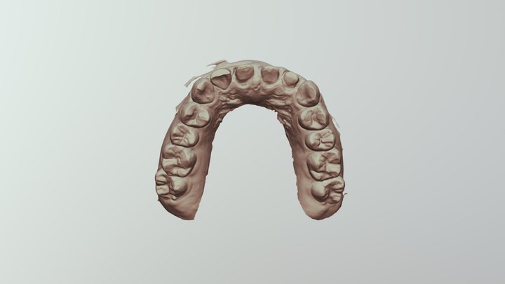 Upper Jaw Scan 3D Model
