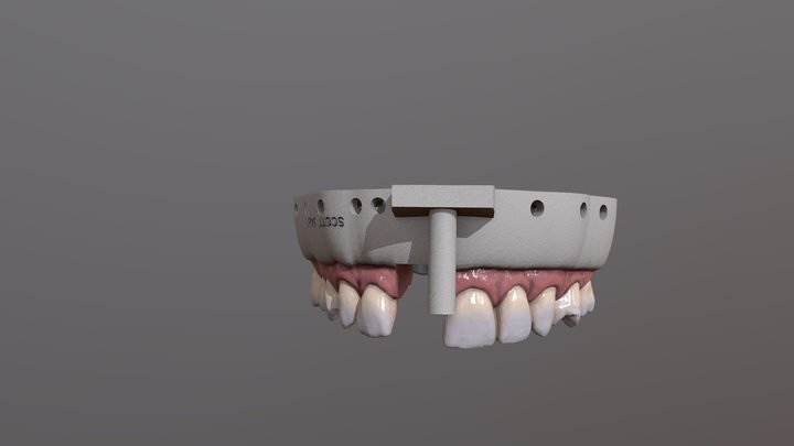 Teeth model Test – Modelo 3D gratuito STL
