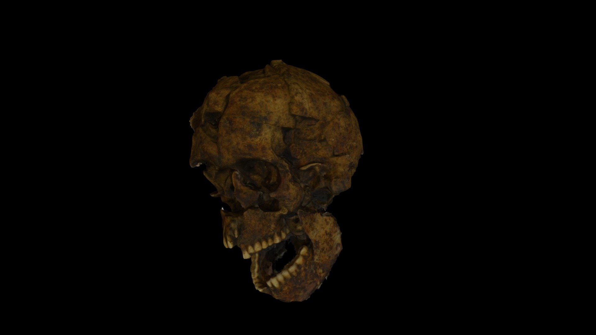 Human skull