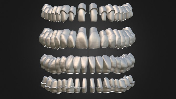 Azure Dental Library with Thimble Crowns 3D Model