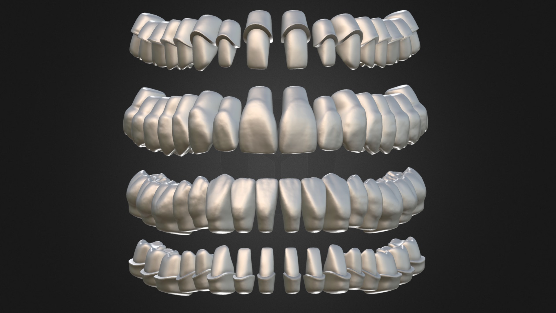 3D model Azure Dental Library with Thimble Crowns