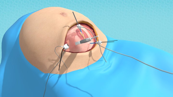 SB_MotherAndFetus_02 3D Model
