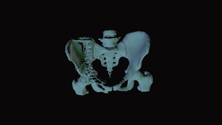 Harry_Segmentationmodelssegmentation 3D Model