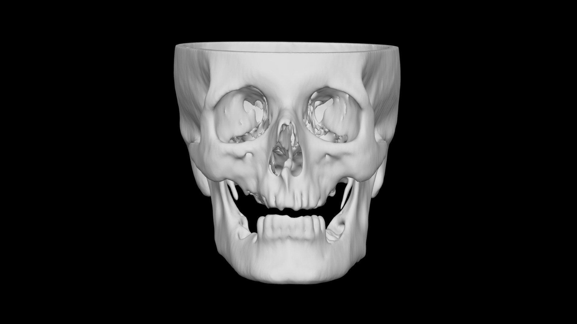 Skull Male 55yo