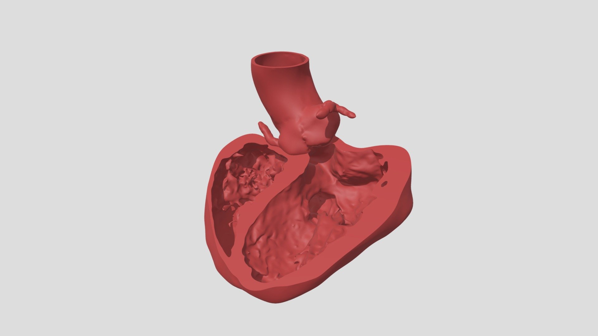 A12SR11012021_V2_AORTA+VENTRICOLI_sezionati