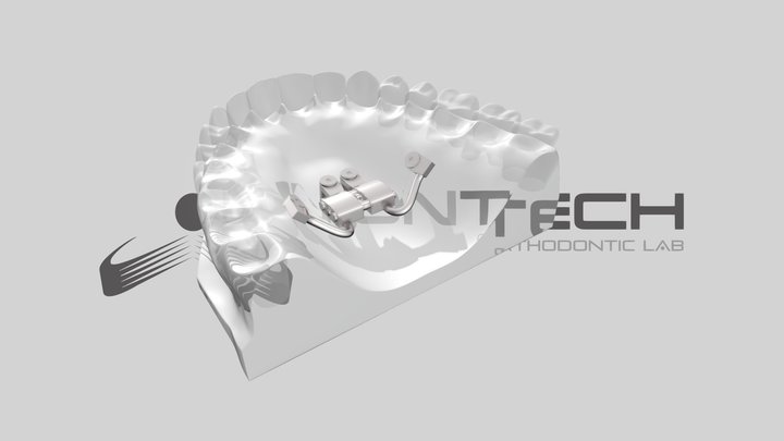 UNIONTECH_Espansore 4 impianti bone borne 3D Model