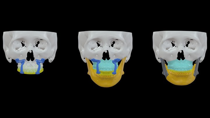Dr.許-易O瑩-0210 3D Model