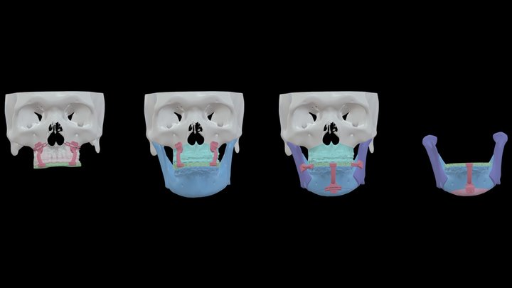 VGHTC-0123-林O鋒 3D Model