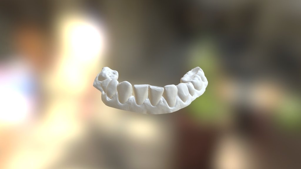 Marta Lower Jaw