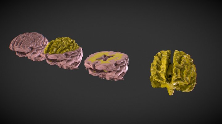 Brain MRI 3D Model