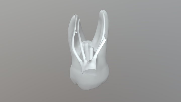 Endodontic #26 model-S 3D Model