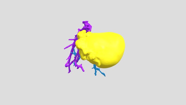 CHC with veins 3D Model