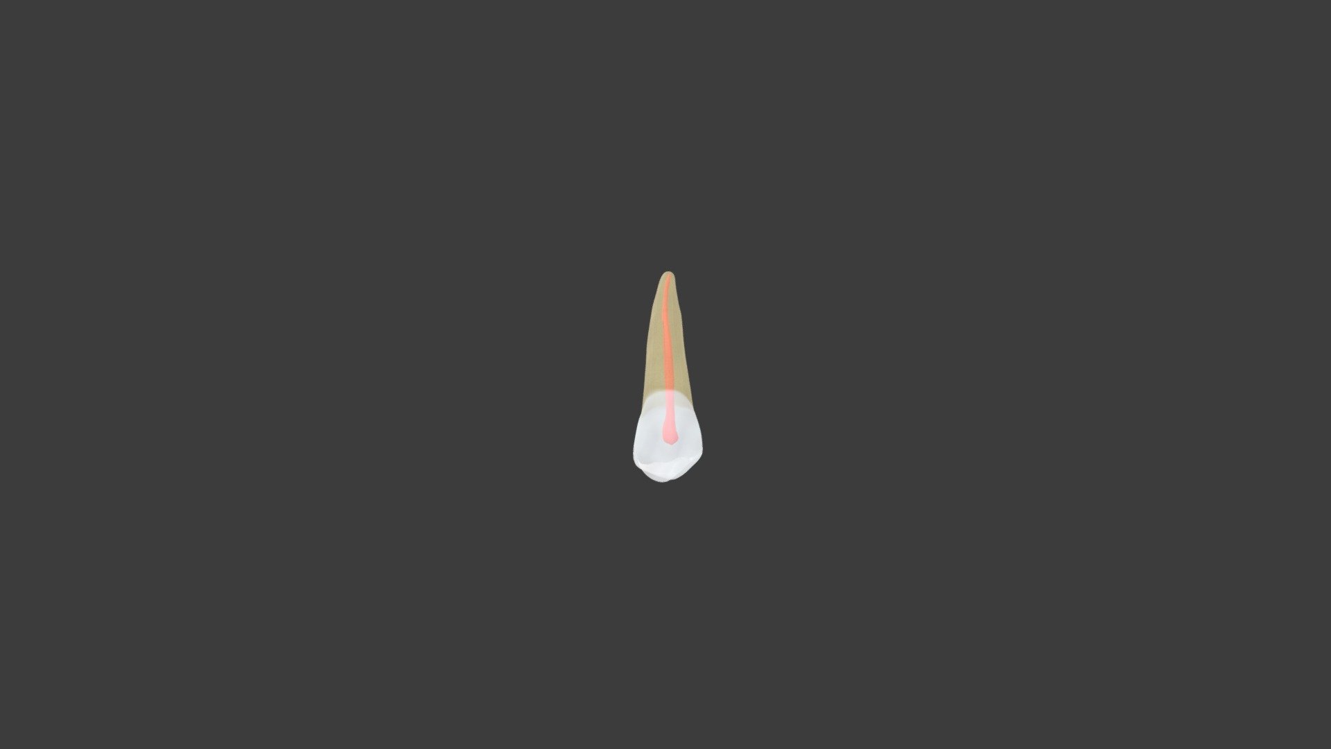 Maxillary 2nd Premolar Type 2