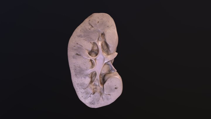 肾的剖面结构 3D Model