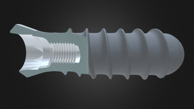 Straumann tissue-level implant 3D Model