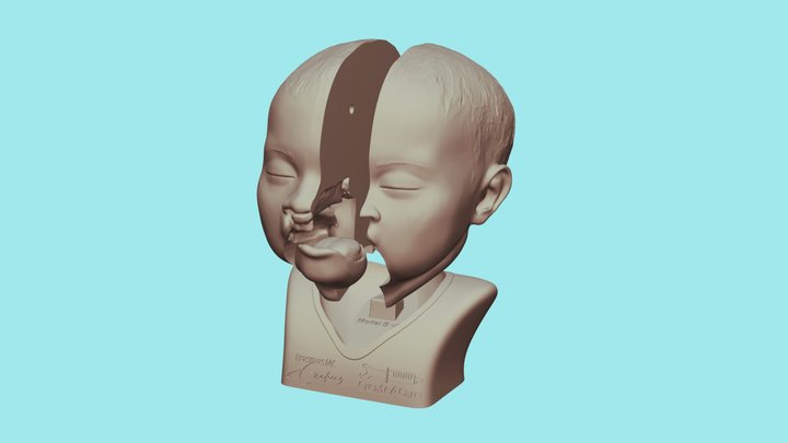 Bilateral cleft lip + palate edu model B Sus 3D Model