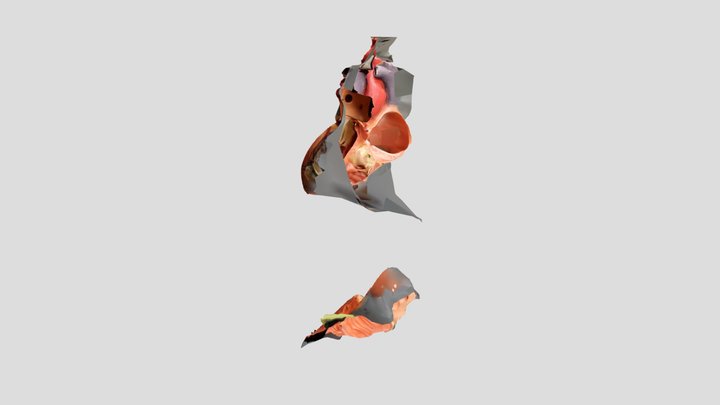 Human heart open
