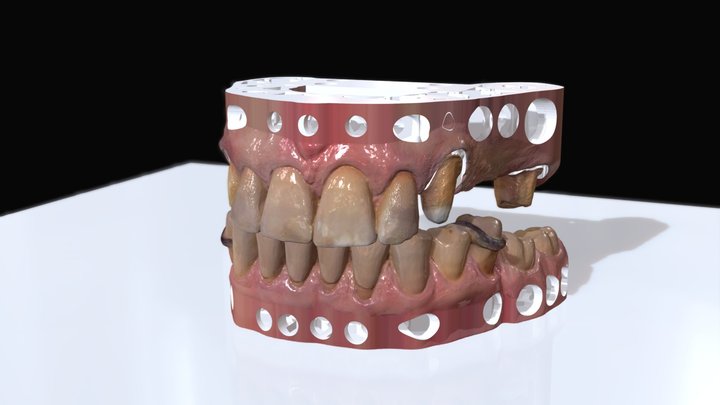 Dental Scan for a denture 3D Model