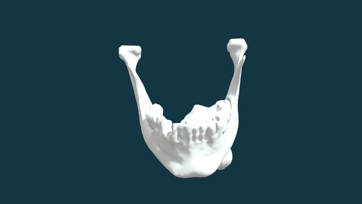TumeurTest 3D Model