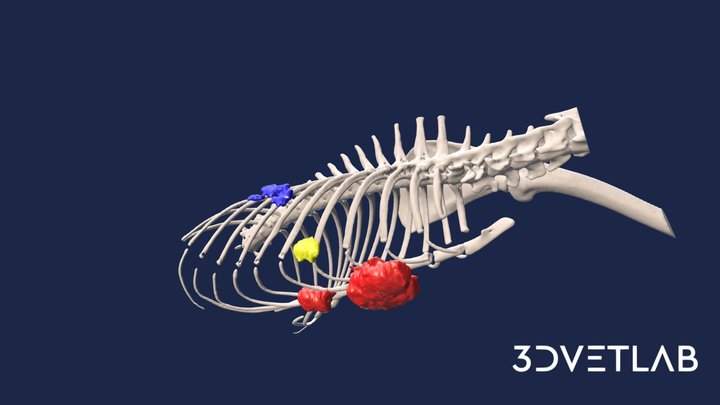 Sarcoma 3D models - Sketchfab