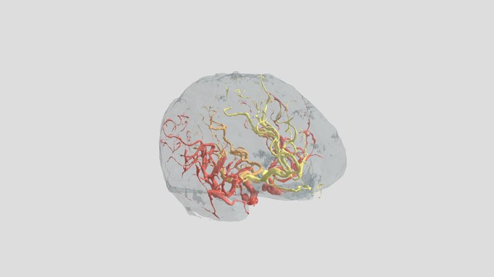 Arterias cerebrales 3D Model
