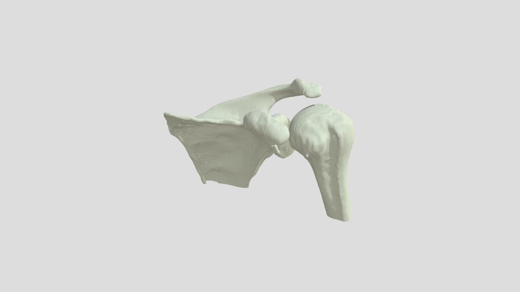 idm-ebre-projecte-3d-fractura-escapular-humer