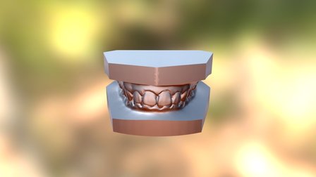 林曉琪 矯正前 3D Model