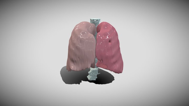 Segmentation of Lungs and Spinal Column 3D Model