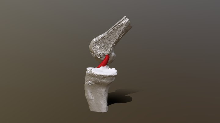 ACL Knee Model 3D Model