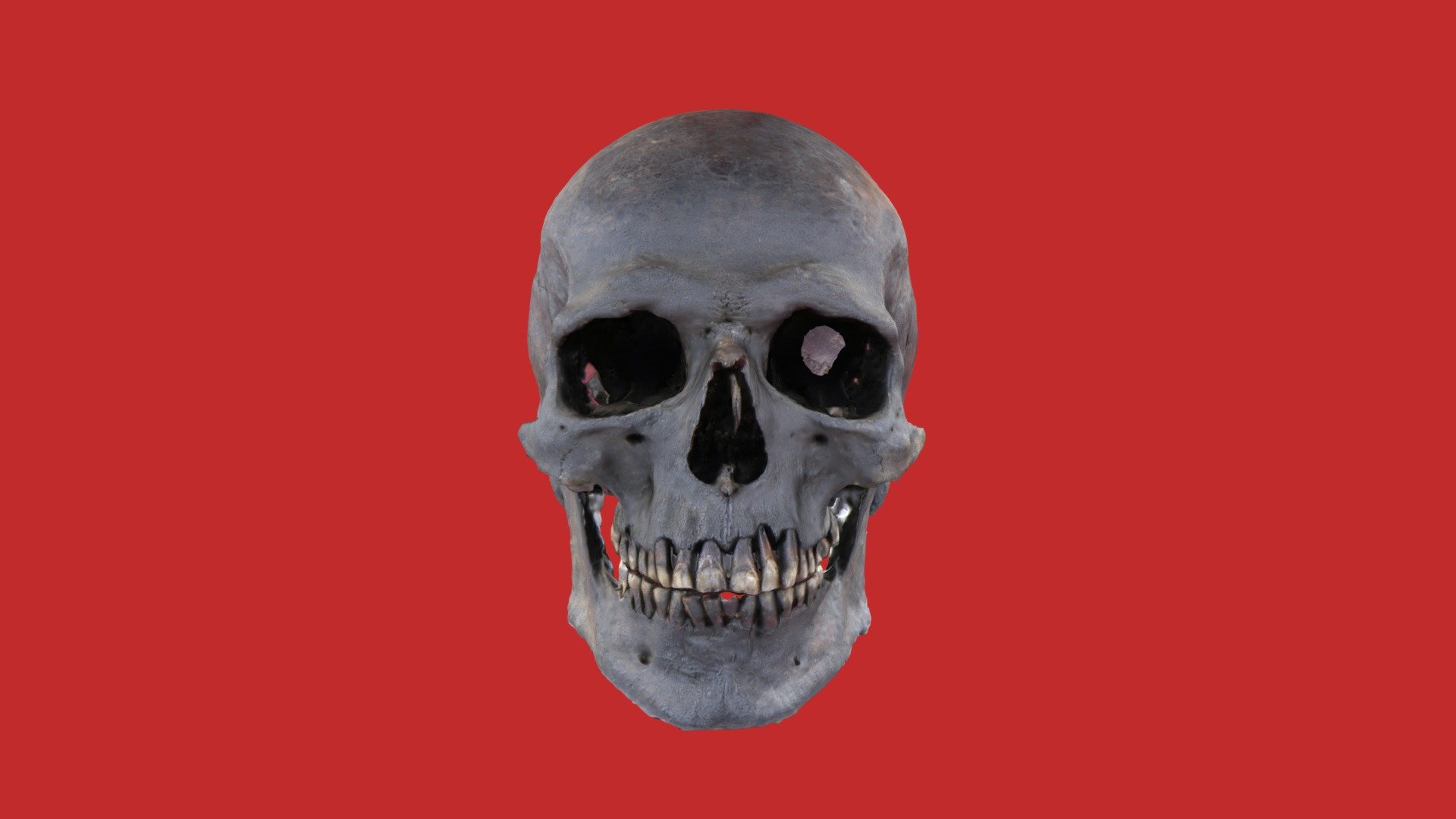 Gristhorpe Man Skull