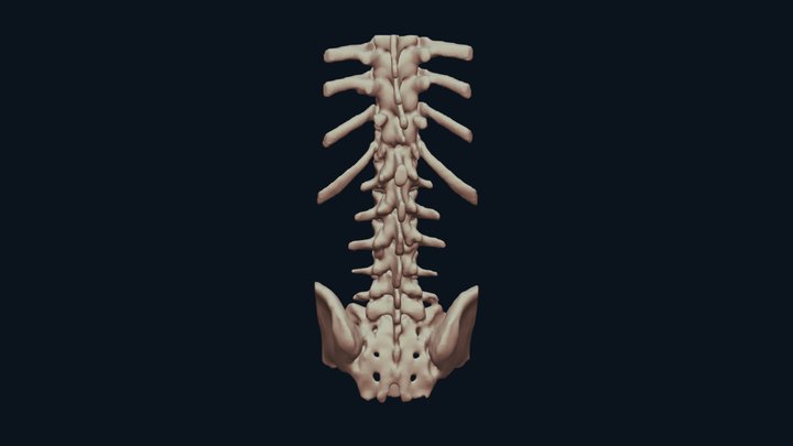 Spine with pars defect 3D Model