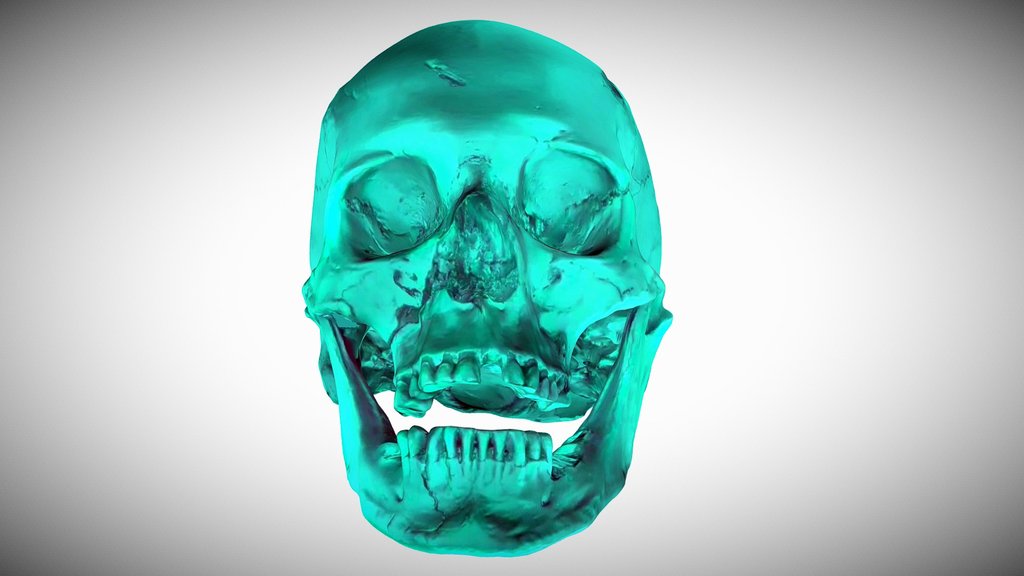 King Richard III Skull 3D Model