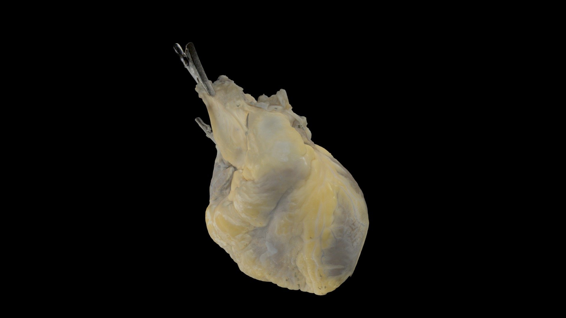 Heart0603 Perfusion Fixed Human Heart