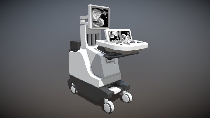 Ultrasound 3D Model