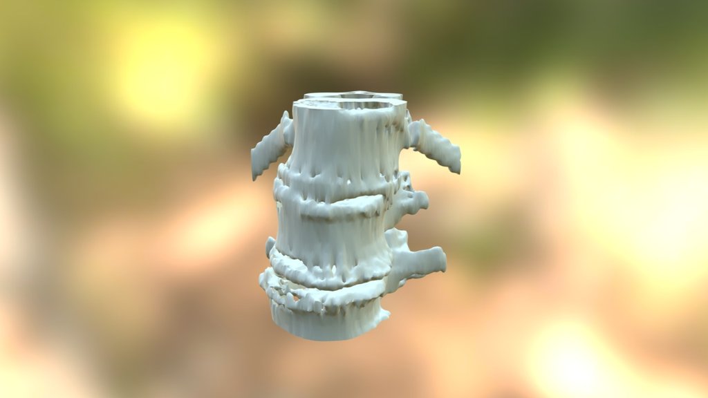 SPINE NEW 1 test