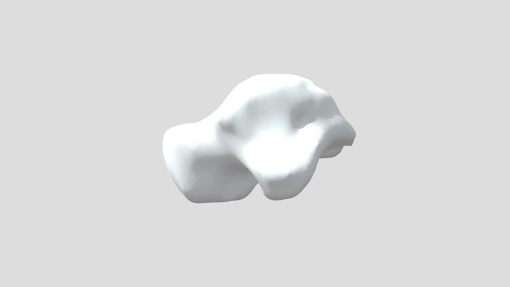 CT 0722 [07450_09360] - InVesalius Sample ASTRAG