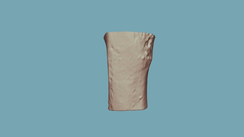 2-3 (Post-burn)