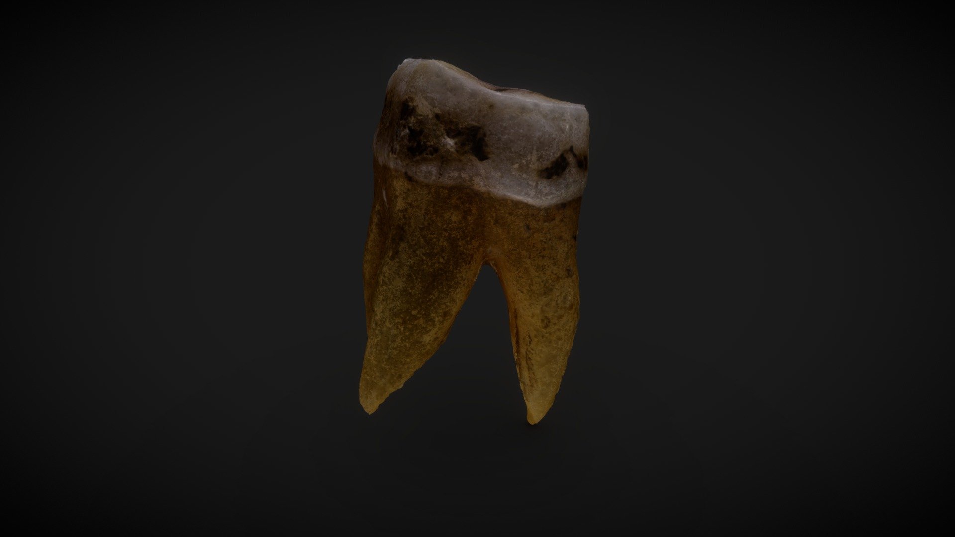 Primer molar