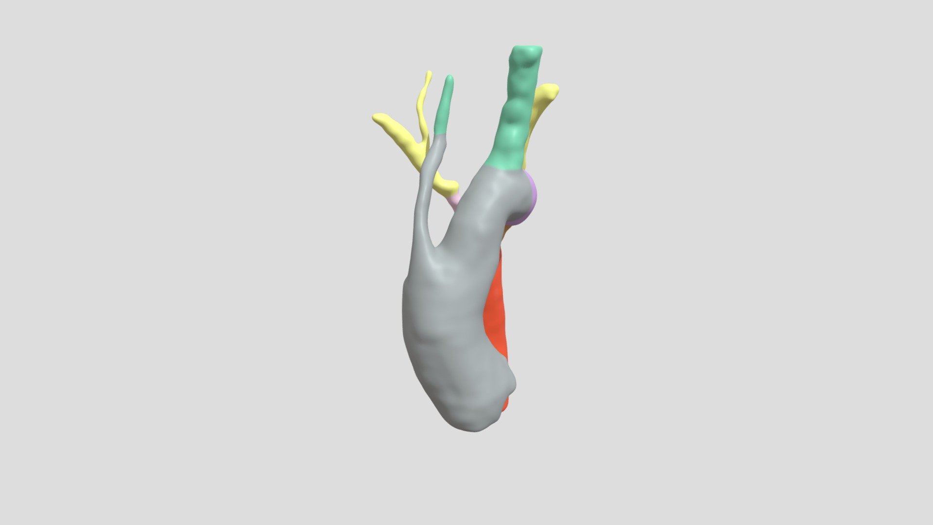 Post-operative - 3D model by Monique Jongbloed (@mrmjongbloed) [554105b ...