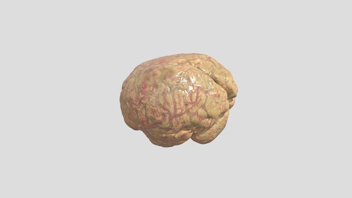 Köln_ Wevers_ Hirn 3D Model