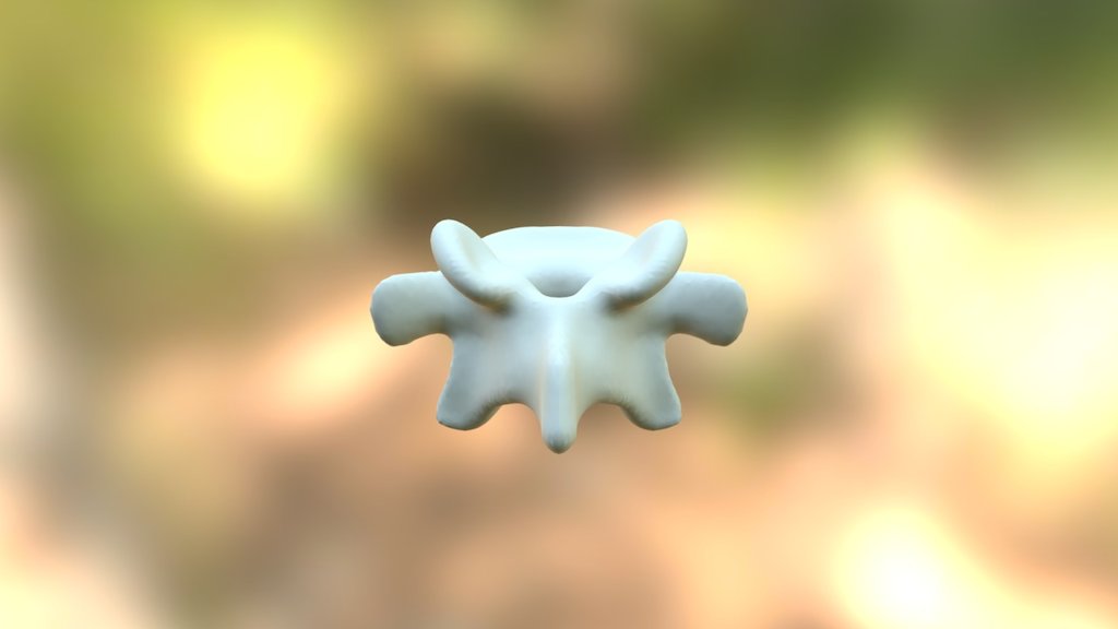 Lumbar Vertebrae
